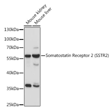 Western Blot - Anti-Somatostatin Receptor 2 Antibody (A90526) - Antibodies.com