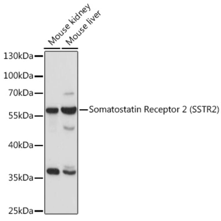 Western Blot - Anti-Somatostatin Receptor 2 Antibody (A90526) - Antibodies.com