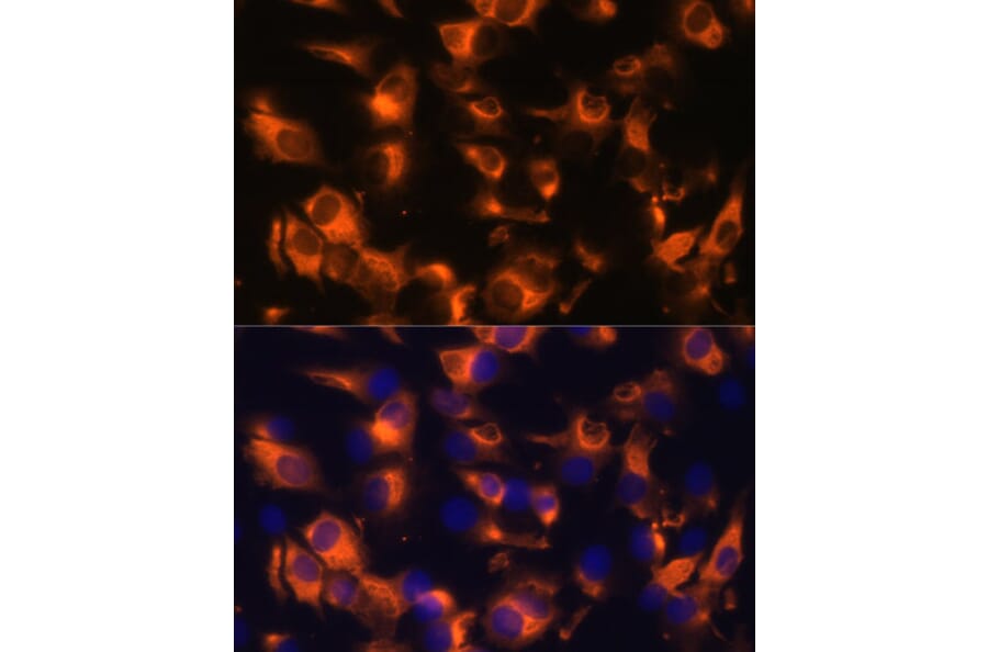 Immunofluorescence - Anti-Somatostatin Receptor 2 Antibody (A90526) - Antibodies.com