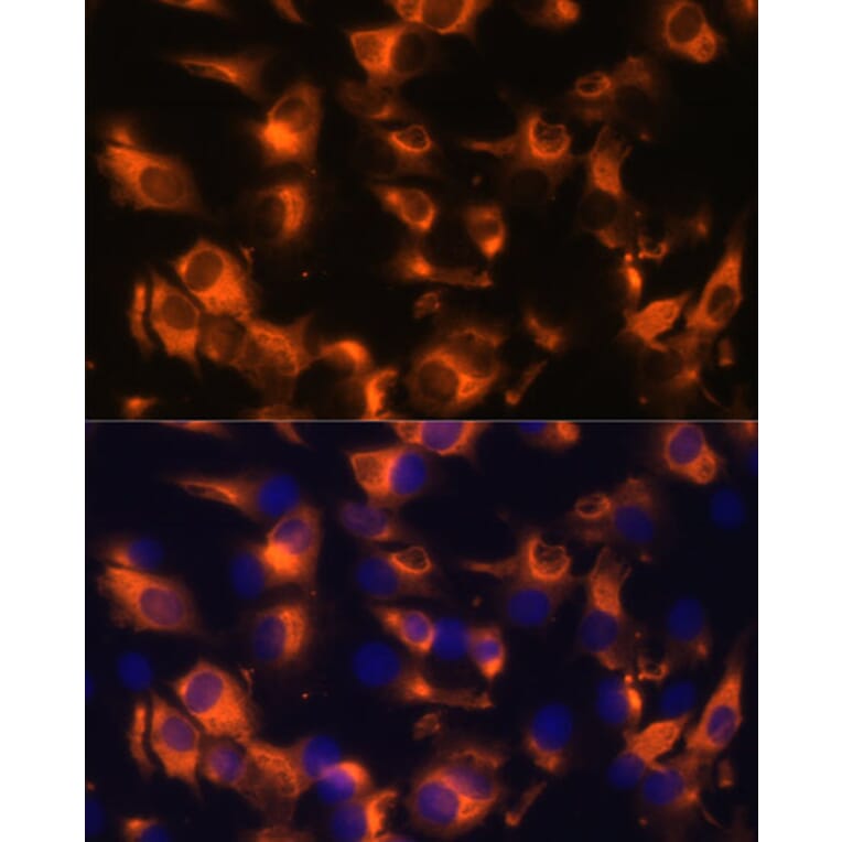 Immunofluorescence - Anti-Somatostatin Receptor 2 Antibody (A90526) - Antibodies.com