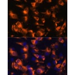 Immunofluorescence - Anti-Somatostatin Receptor 2 Antibody (A90526) - Antibodies.com