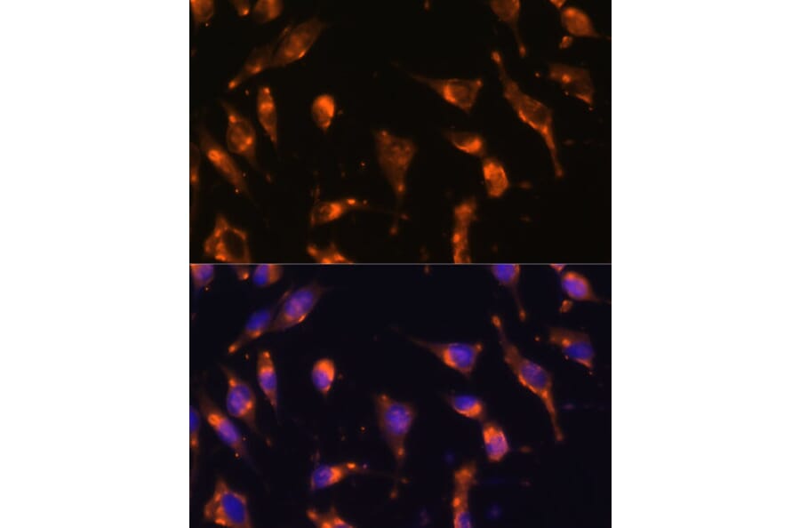 Immunofluorescence - Anti-Somatostatin Receptor 2 Antibody (A90526) - Antibodies.com