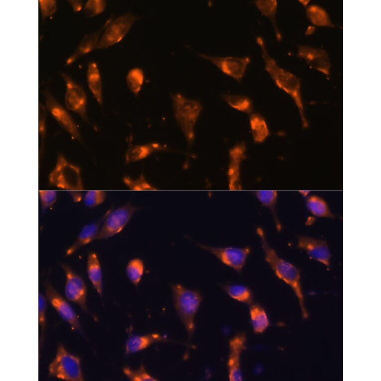 Immunofluorescence - Anti-Somatostatin Receptor 2 Antibody (A90526) - Antibodies.com