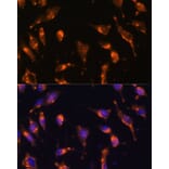 Immunofluorescence - Anti-Somatostatin Receptor 2 Antibody (A90526) - Antibodies.com