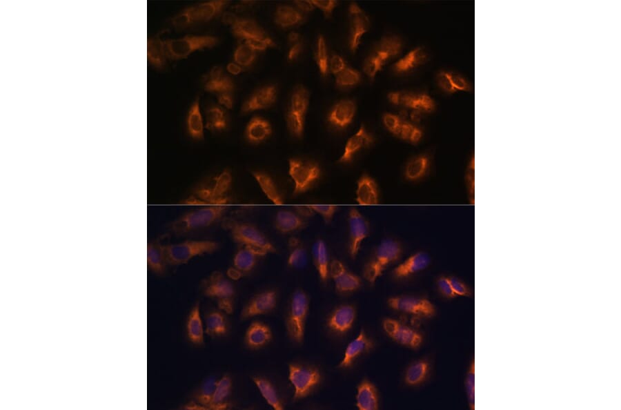 Immunofluorescence - Anti-Somatostatin Receptor 2 Antibody (A90526) - Antibodies.com