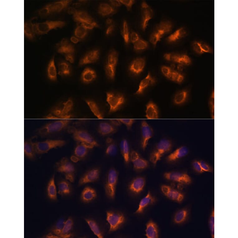 Immunofluorescence - Anti-Somatostatin Receptor 2 Antibody (A90526) - Antibodies.com