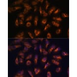 Immunofluorescence - Anti-Somatostatin Receptor 2 Antibody (A90526) - Antibodies.com