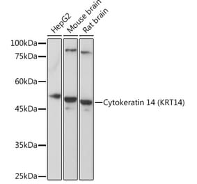 Western Blot - Anti-Cytokeratin 14 Antibody (A90527) - Antibodies.com