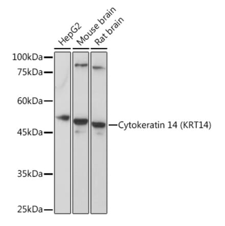 Western Blot - Anti-Cytokeratin 14 Antibody (A90527) - Antibodies.com