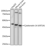 Western Blot - Anti-Cytokeratin 14 Antibody (A90527) - Antibodies.com