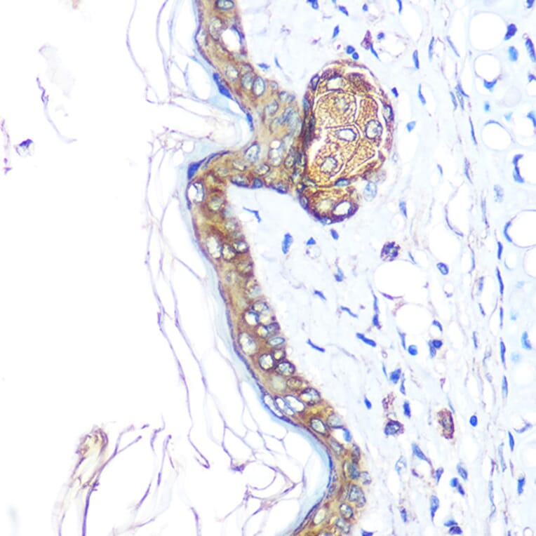 Immunohistochemistry - Anti-Cytokeratin 14 Antibody (A90527) - Antibodies.com