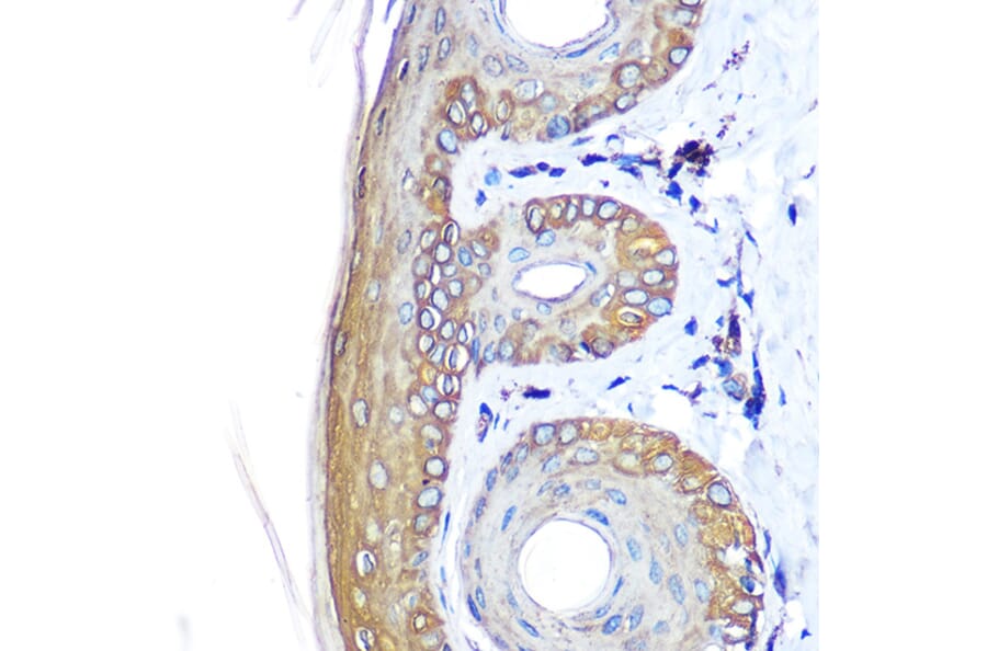 Immunohistochemistry - Anti-Cytokeratin 14 Antibody (A90527) - Antibodies.com