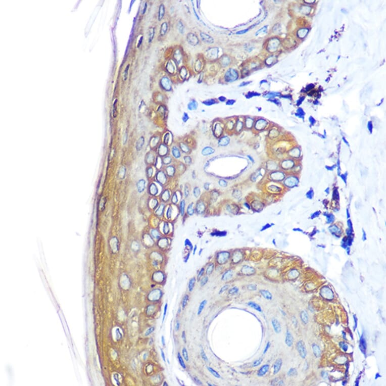 Immunohistochemistry - Anti-Cytokeratin 14 Antibody (A90527) - Antibodies.com