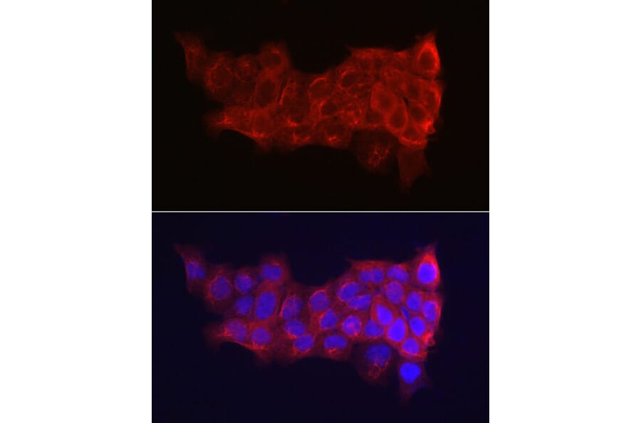 Immunofluorescence - Anti-Cytokeratin 14 Antibody (A90527) - Antibodies.com