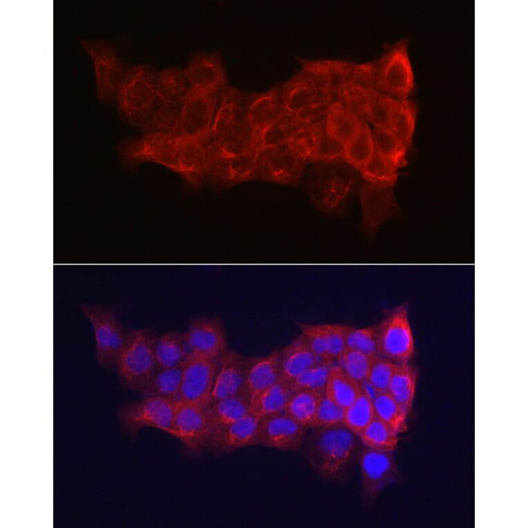 Immunofluorescence - Anti-Cytokeratin 14 Antibody (A90527) - Antibodies.com