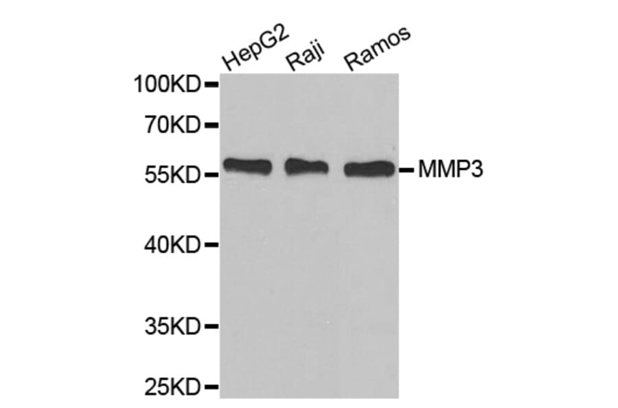 Western Blot - Anti-MMP3 Antibody (A6260) - Antibodies.com
