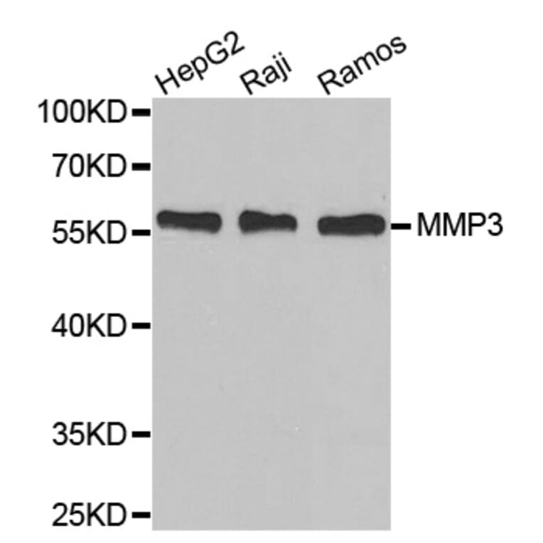 Western Blot - Anti-MMP3 Antibody (A6260) - Antibodies.com