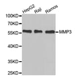 Western Blot - Anti-MMP3 Antibody (A6260) - Antibodies.com