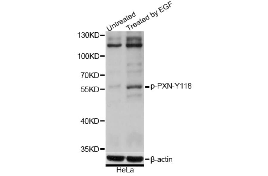 Western Blot - Anti-PXN (phospho Y118) Antibody (AP0766) - Antibodies.com