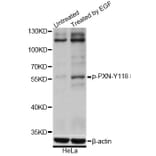 Western Blot - Anti-PXN (phospho Y118) Antibody (AP0766) - Antibodies.com