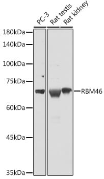 Western blot analysis of extracts of various cell lines, using Anti-RBM46 Antibody (A16605) at 1:1,000 dilution.
Secondary antibody: Goat Anti-Rabbit IgG (H+L) (HRP) (AS014) at 1:10,000 dilution.
Lysates / proteins: 25µg per lane.
Blocking buffer: 3% non-fat dry milk in TBST.
Detection: ECL Basic Kit (RM00020).
Exposure time: 10s.