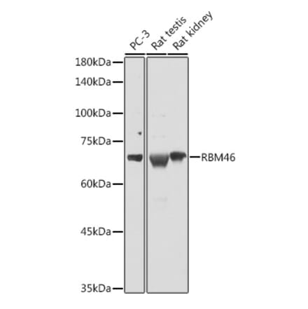 Western Blot - Anti-RBM46 Antibody (A90530) - Antibodies.com