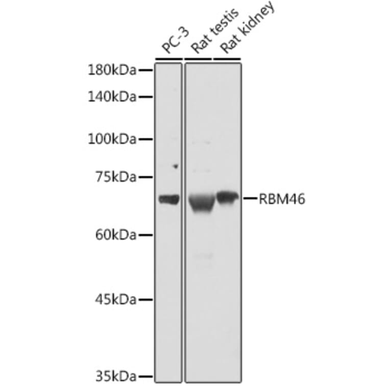 Western Blot - Anti-RBM46 Antibody (A90530) - Antibodies.com
