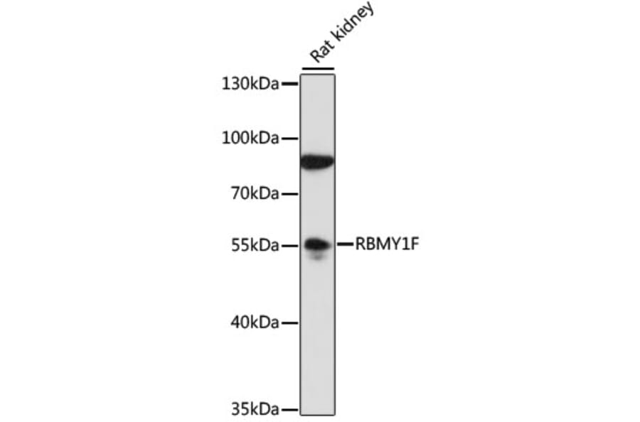 Western Blot - Anti-RBMY1F Antibody (A90531) - Antibodies.com