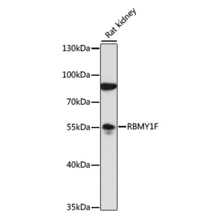 Western Blot - Anti-RBMY1F Antibody (A90531) - Antibodies.com