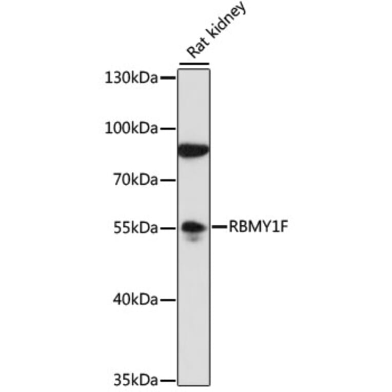 Western Blot - Anti-RBMY1F Antibody (A90531) - Antibodies.com