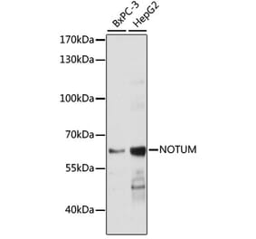 Western Blot - Anti-NOTUM Antibody (A90532) - Antibodies.com