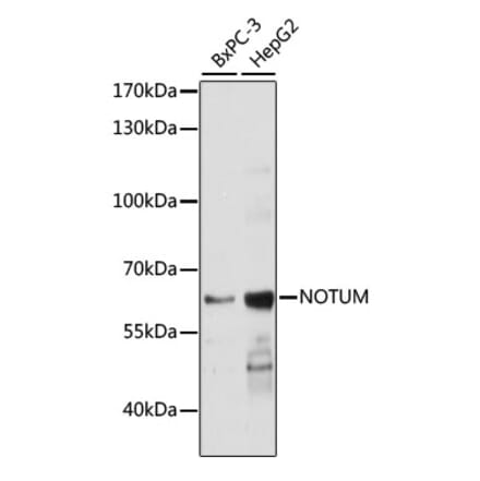 Western Blot - Anti-NOTUM Antibody (A90532) - Antibodies.com