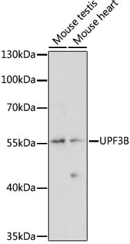 Western blot analysis of extracts of various cell lines, using Anti-UPF3B Antibody (A15184) at 1:1,000 dilution.
Secondary antibody: Goat Anti-Rabbit IgG (H+L) (HRP) (AS014) at 1:10,000 dilution.
Lysates / proteins: 25µg per lane.
Blocking buffer: 3% non-fat dry milk in TBST.
Detection: ECL Basic Kit (RM00020).
Exposure time: 10s.