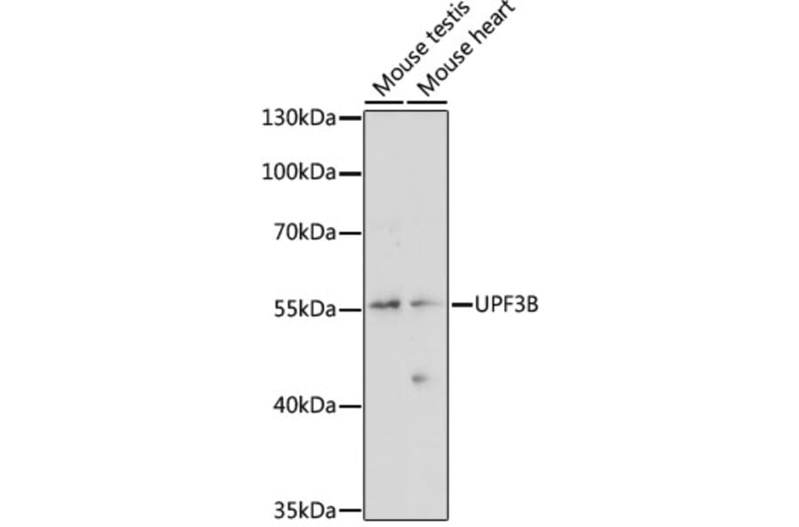 Western Blot - Anti-UPF3B/RENT3B Antibody (A90533) - Antibodies.com
