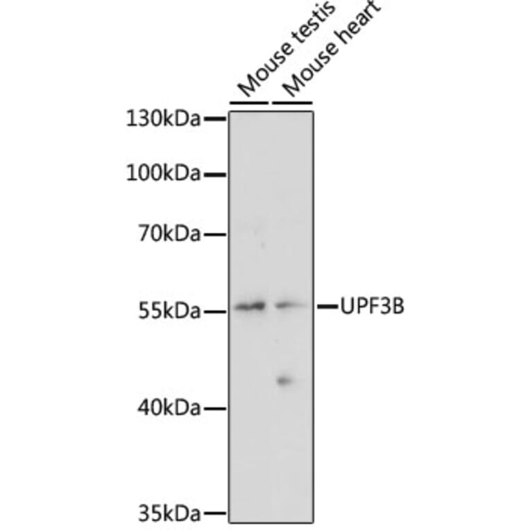Western Blot - Anti-UPF3B/RENT3B Antibody (A90533) - Antibodies.com