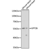 Western Blot - Anti-UPF3B/RENT3B Antibody (A90533) - Antibodies.com