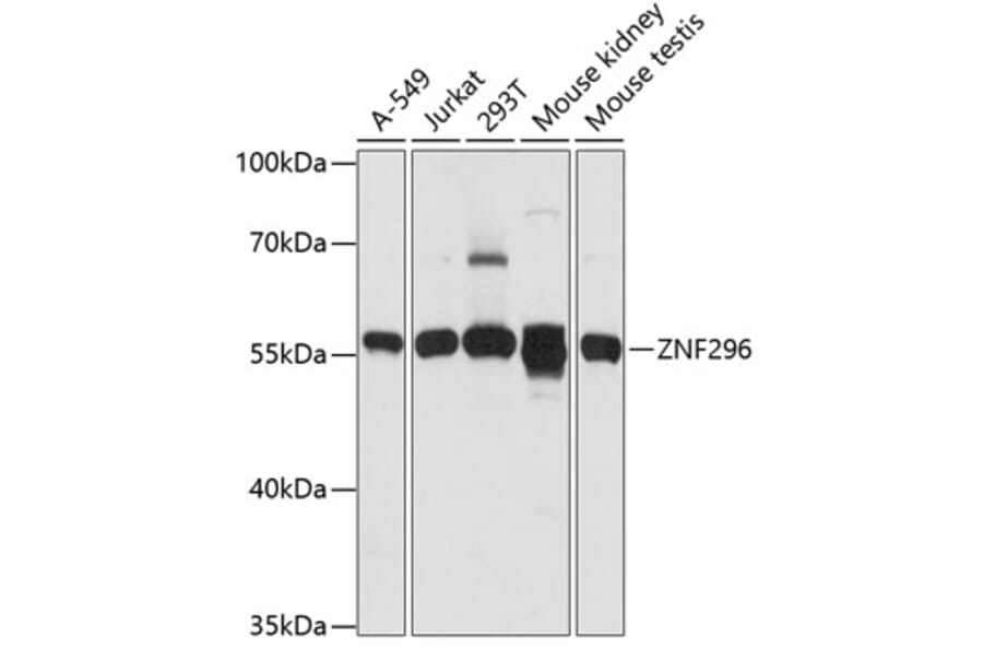 Western Blot - Anti-ZNF296 Antibody (A90534) - Antibodies.com