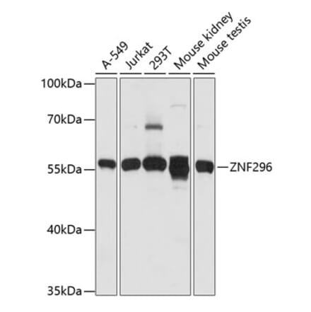 Western Blot - Anti-ZNF296 Antibody (A90534) - Antibodies.com