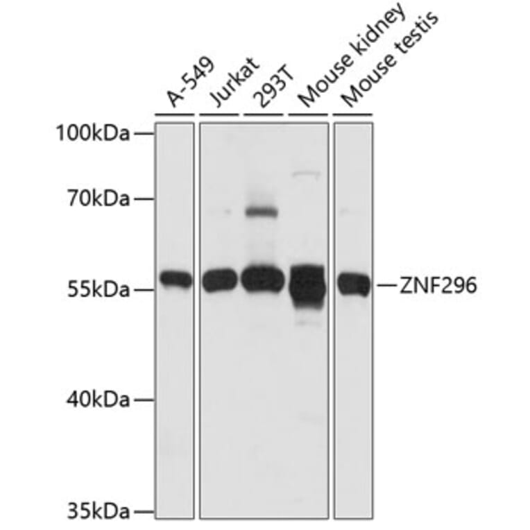 Western Blot - Anti-ZNF296 Antibody (A90534) - Antibodies.com