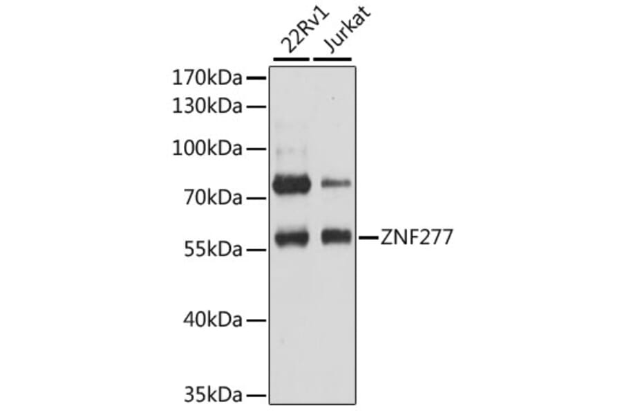 Western Blot - Anti-ZNF277 Antibody (A12825) - Antibodies.com