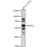 Western Blot - Anti-MKRN3 Antibody (A90537) - Antibodies.com