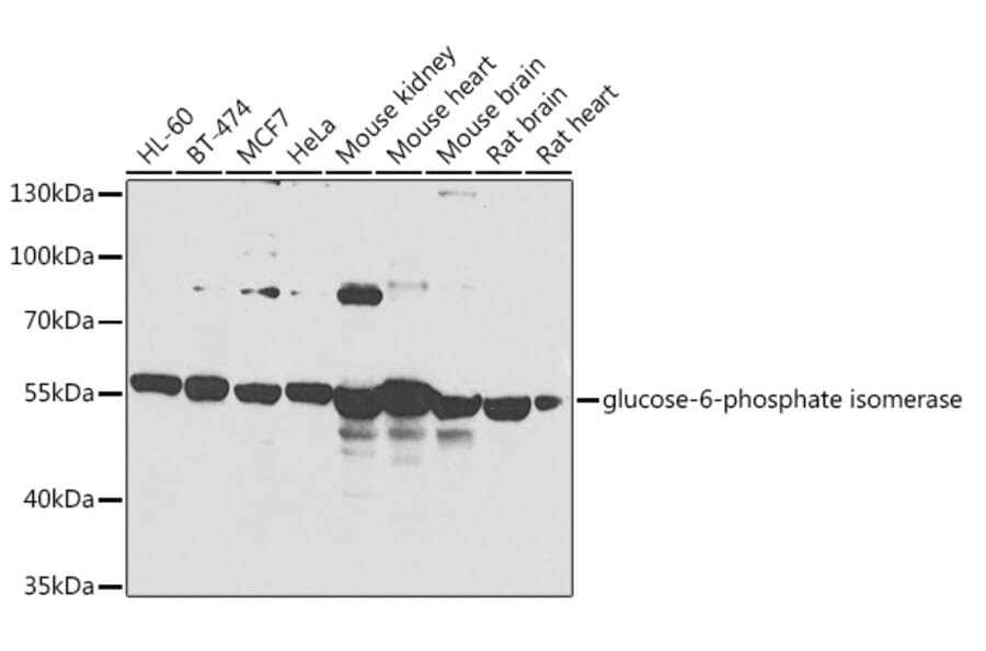 Western Blot - Anti-Glucose 6 Phosphate Isomerase Antibody (A90538) - Antibodies.com