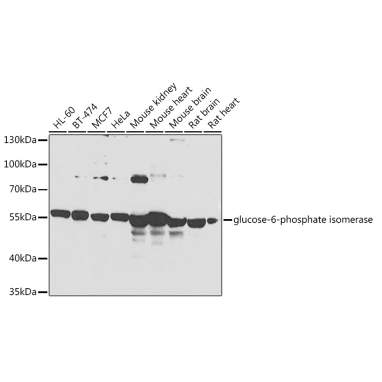 Western Blot - Anti-Glucose 6 Phosphate Isomerase Antibody (A90538) - Antibodies.com