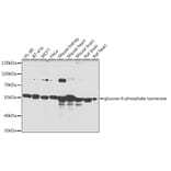Western Blot - Anti-Glucose 6 Phosphate Isomerase Antibody (A90538) - Antibodies.com