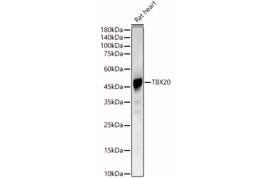 Western Blot - Anti-Tbx20 Antibody (A90539) - Antibodies.com
