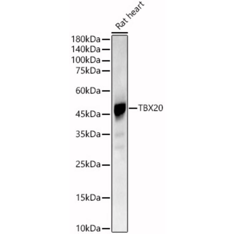 Western Blot - Anti-Tbx20 Antibody (A90539) - Antibodies.com