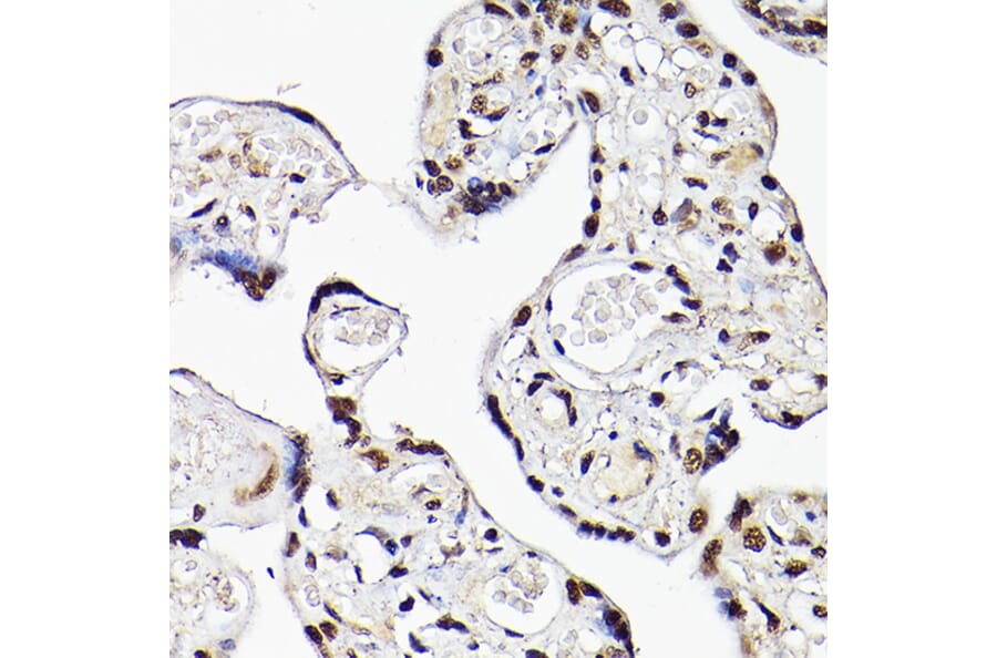 Immunohistochemistry - Anti-Tbx20 Antibody (A90539) - Antibodies.com