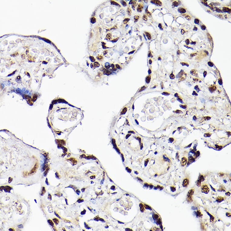 Immunohistochemistry - Anti-Tbx20 Antibody (A90539) - Antibodies.com