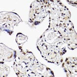 Immunohistochemistry - Anti-Tbx20 Antibody (A90539) - Antibodies.com