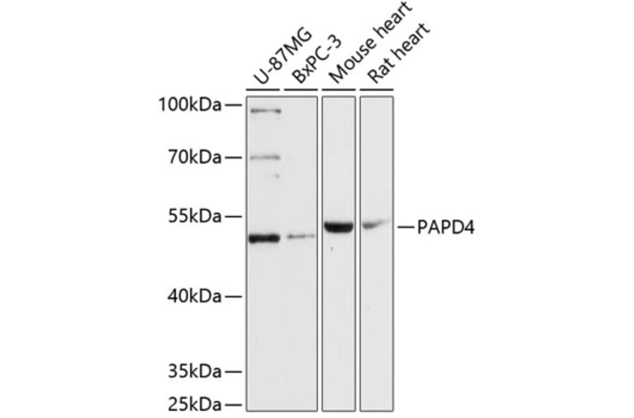 Western Blot - Anti-TENT2 Antibody (A90540) - Antibodies.com